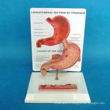 Enseignement médical Modèle anatomique de l&#39;estomac humain (R100208)